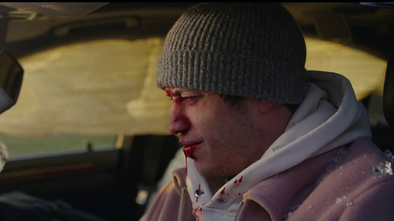 Pete Davidson bleeding