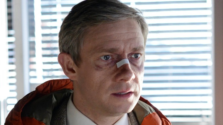 Lester Nygaard with an injured nose