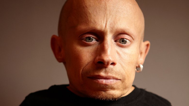 Verne Troyer