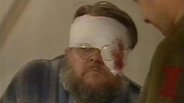 A bandaged Bill Wallis glares