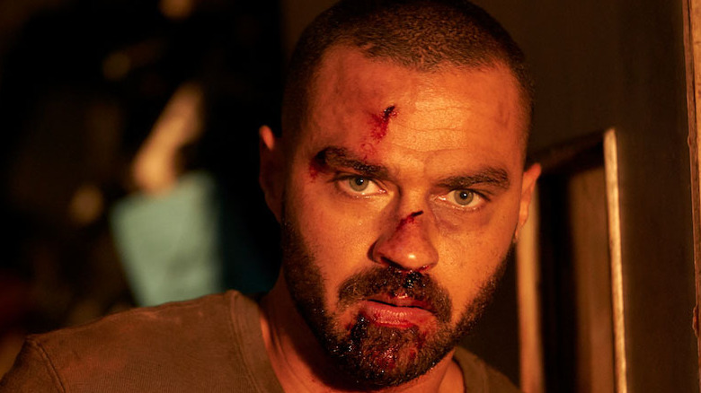 Jesse Williams has facial cuts