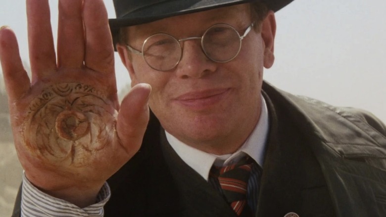 Ronald Lacey holds up scarred hand