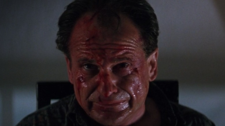 Joe Pesci bleeding