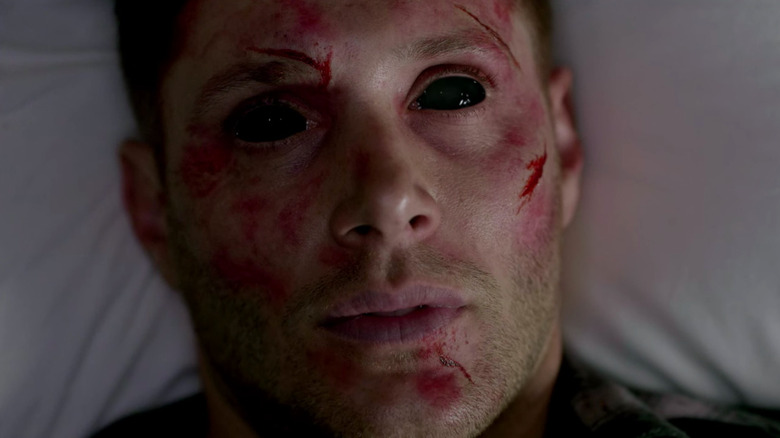 Dean's eyes are blacked out after he becomes a demon