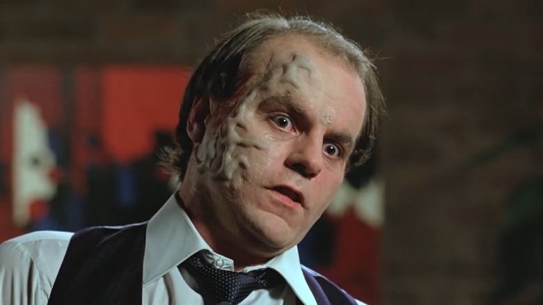 Michael Ironside swelling face