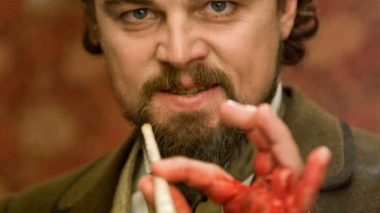 DiCaprio with a cut hand on set