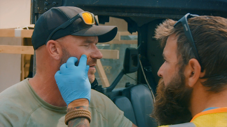 Fred removing shrapnel from Stuart's face