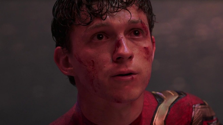 Spider-Man with beat up face