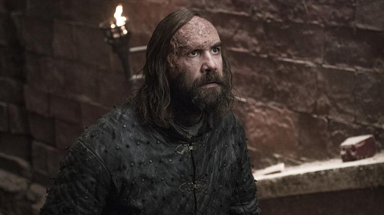 The Hound scarred face 