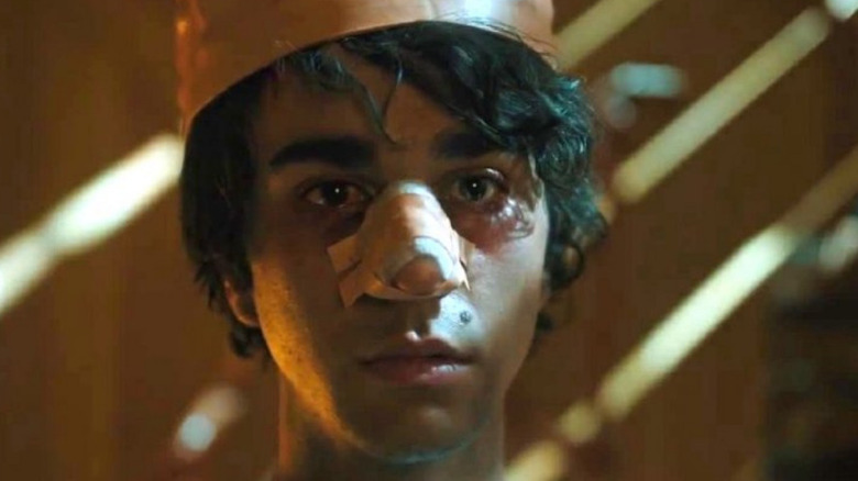 A bruised Alex Wolff