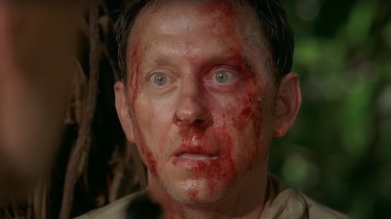 Ben Linus with his face covered in blood