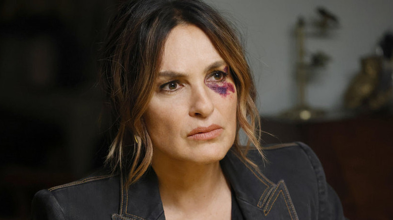 Olivia Benson with bruise