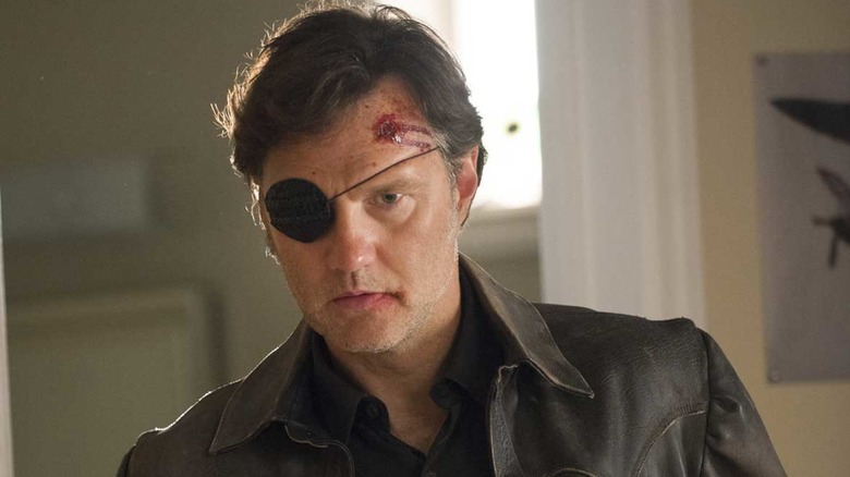 The Governor with head wound