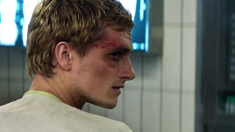 Peeta with bruises on his face