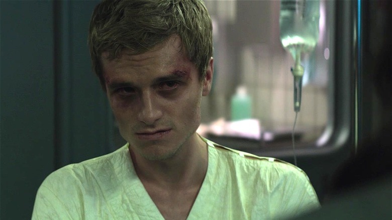 Bruised Peeta in District 13