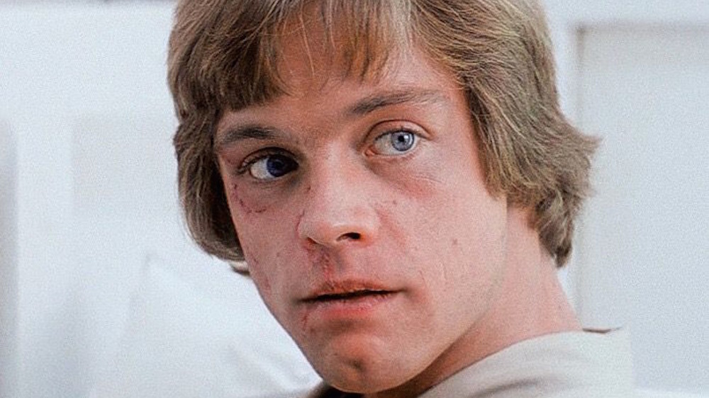 Luke Skywalker after injury