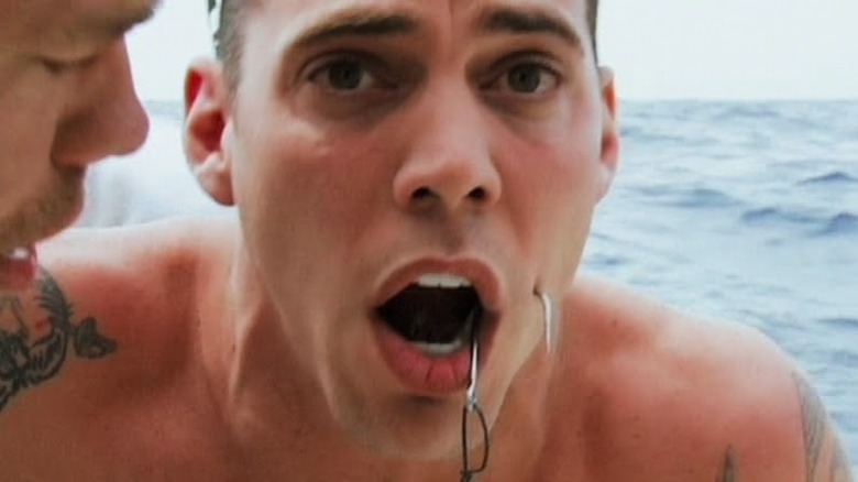 Steve-O with fish hook in cheek