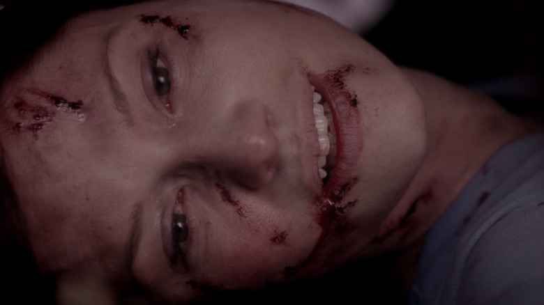 Close up of Lexie dying