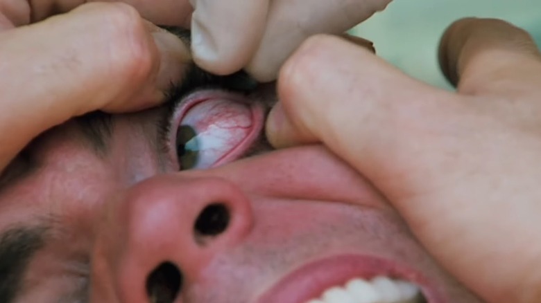 Steve-O gets leech on eyeball Jackass