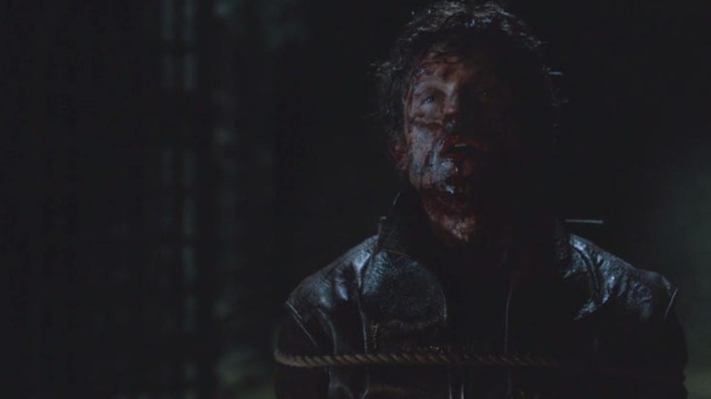 Ramsay Bolton with blood on his face