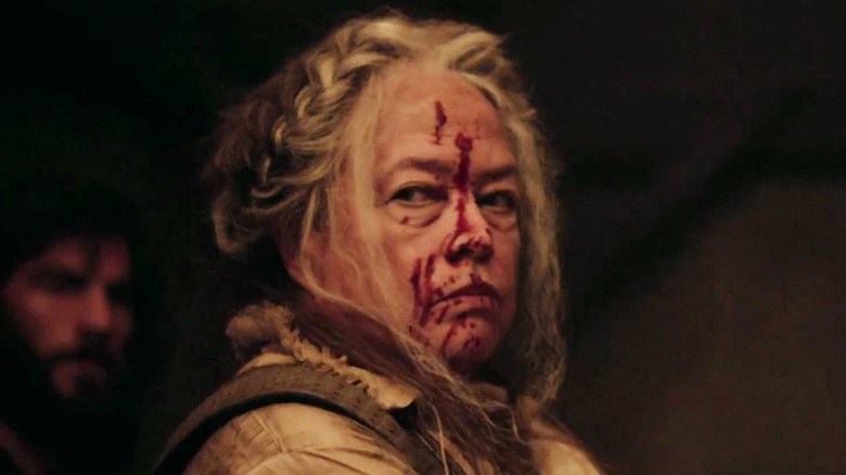 Kathy Bates with blood on her face