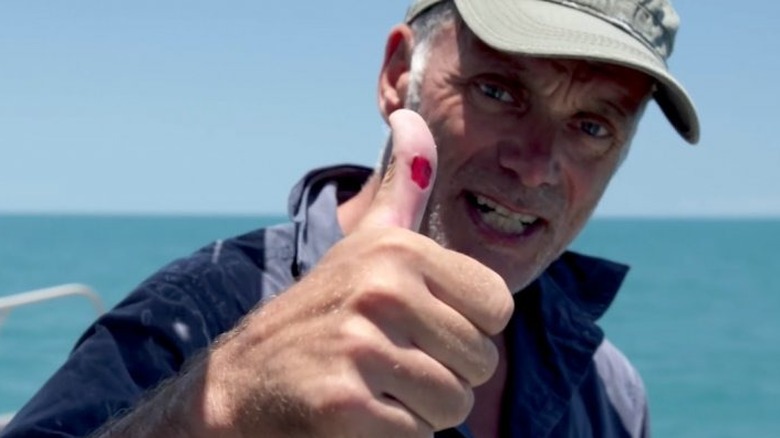 Jeremy Wade showing a cut