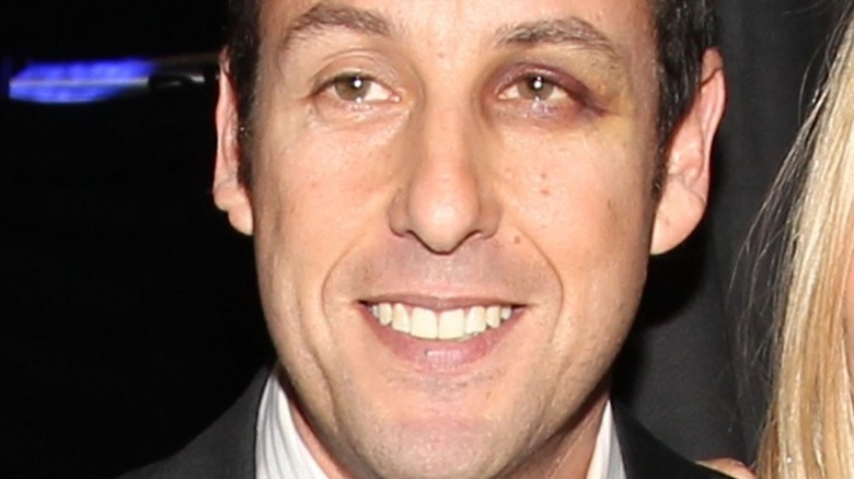  Adam Sandler smiles with black eye