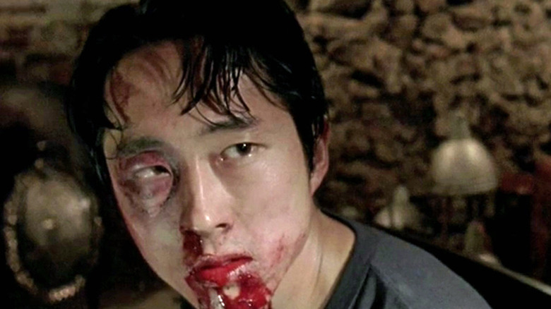 Glenn beaten up and bloodied