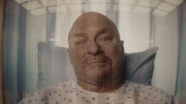 Stephen Root bald in hospital gown in Get Out