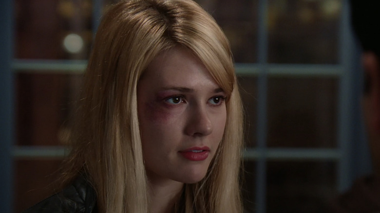 Tori Anderson Liz Anderson Rookie Blue black eye